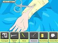 Arm Surgery 2
