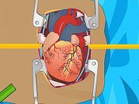 Heart Surgery